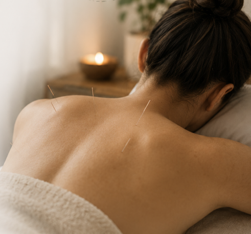 Acupuncture